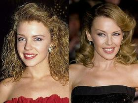 Kylie Minogue