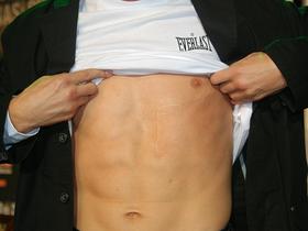 Rafal Jackiewicz