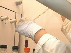 Sanolabor bo za dober milijon opremil hematološki oddelek