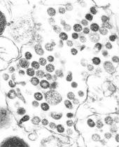 V Veliki Britaniji umrl bolnik z novim koronavirusom