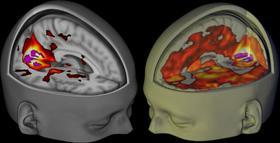 Človeški možgani po klinični smrti telesa živijo naprej