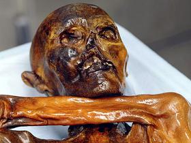 Ötzi