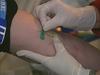 Ob evropskem tednu testiranja na HIV ter hepatitis B in C na infekcijski kliniki UKC Ljubljana vsak dan poteka anonimno in brezplačno testiranje na omenjene viruse. Foto: MMC RTV SLO