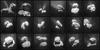 Rosetta, 67P/Čurjumov-Gerasimenko