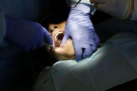Zobozdravniki: Belih zalivk ZZZS ne krije v celoti