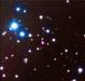 Magnetar SGR 0418