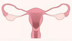 Za endometriozo trpi do 15 odstotkov žensk