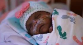 Z 245 grami najlažja novorojenka na svetu zapustila porodnišnico