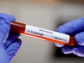 Kako je na koronavirus pripravljena Primorska?