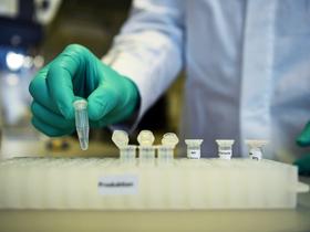 Anteil der positiven Tests liegt momentan bei 30 Prozent