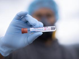 Gestern neun Infektionen mit dem Coronavirus und ein Toter