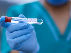 Epidemiologische Situation in Slowenien stabil