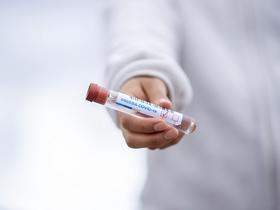 30 new coronavirus cases confirmed in Slovenia