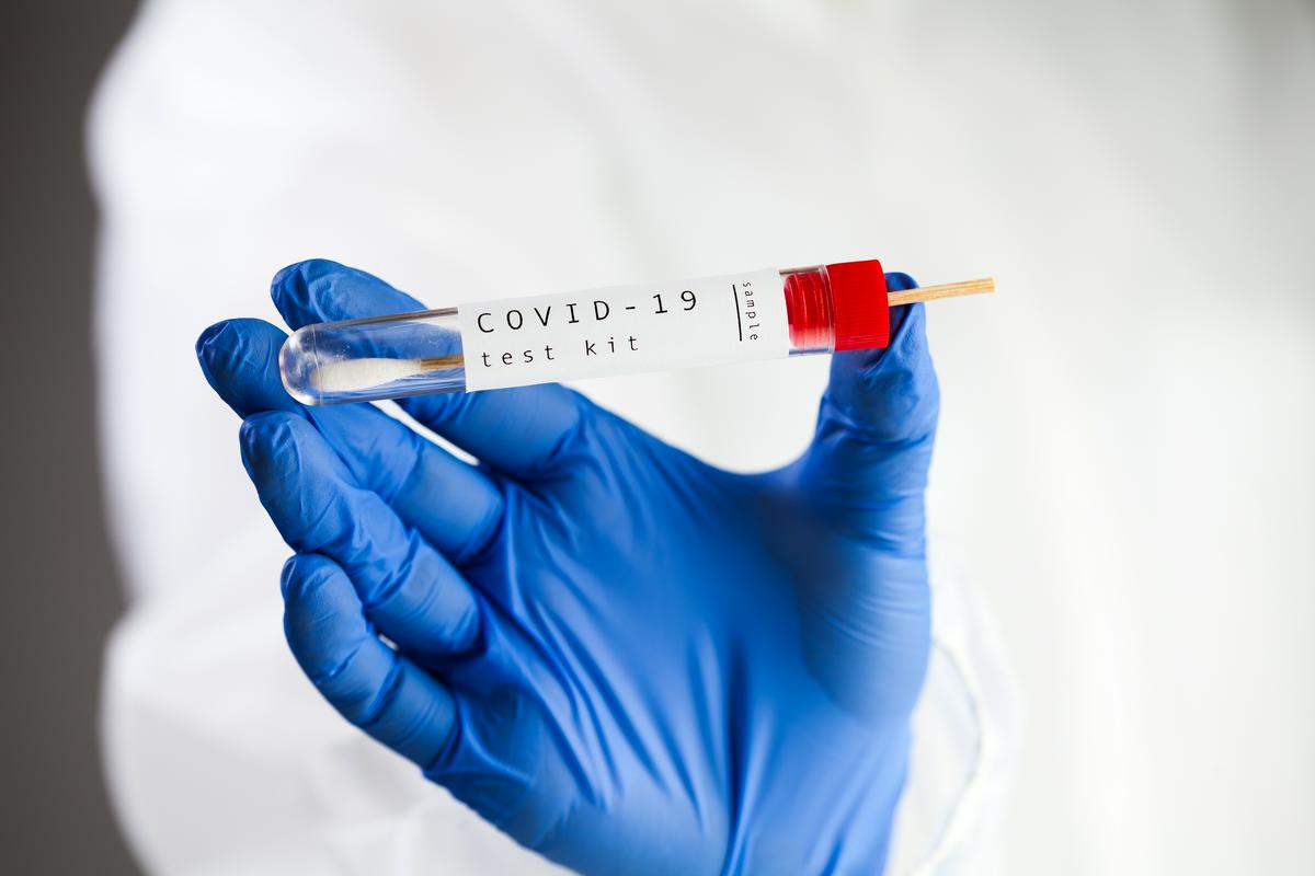 Epruveta z napisom COVID-19. Foto: Shutterstock Epruveta z napisom COVID-19. Foto: Shutterstock